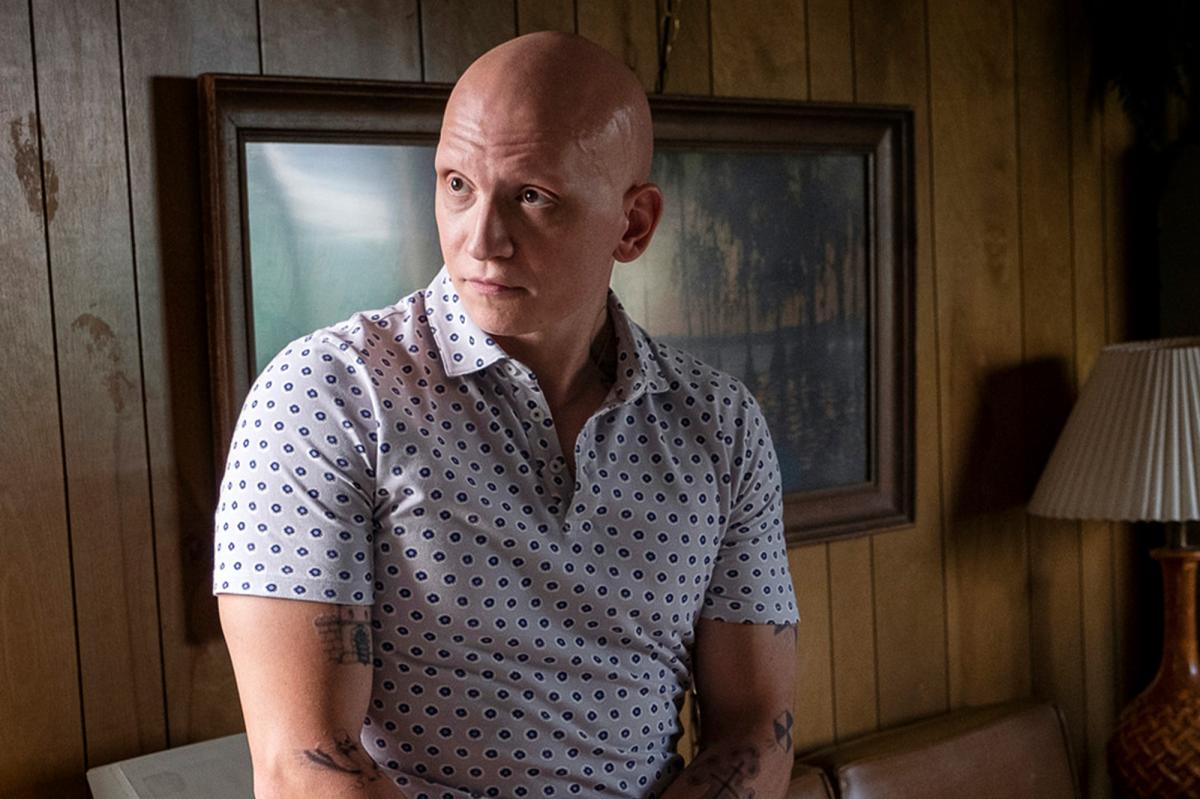 Anthony Carrigan Says Alopecia Made Him A Better Actor