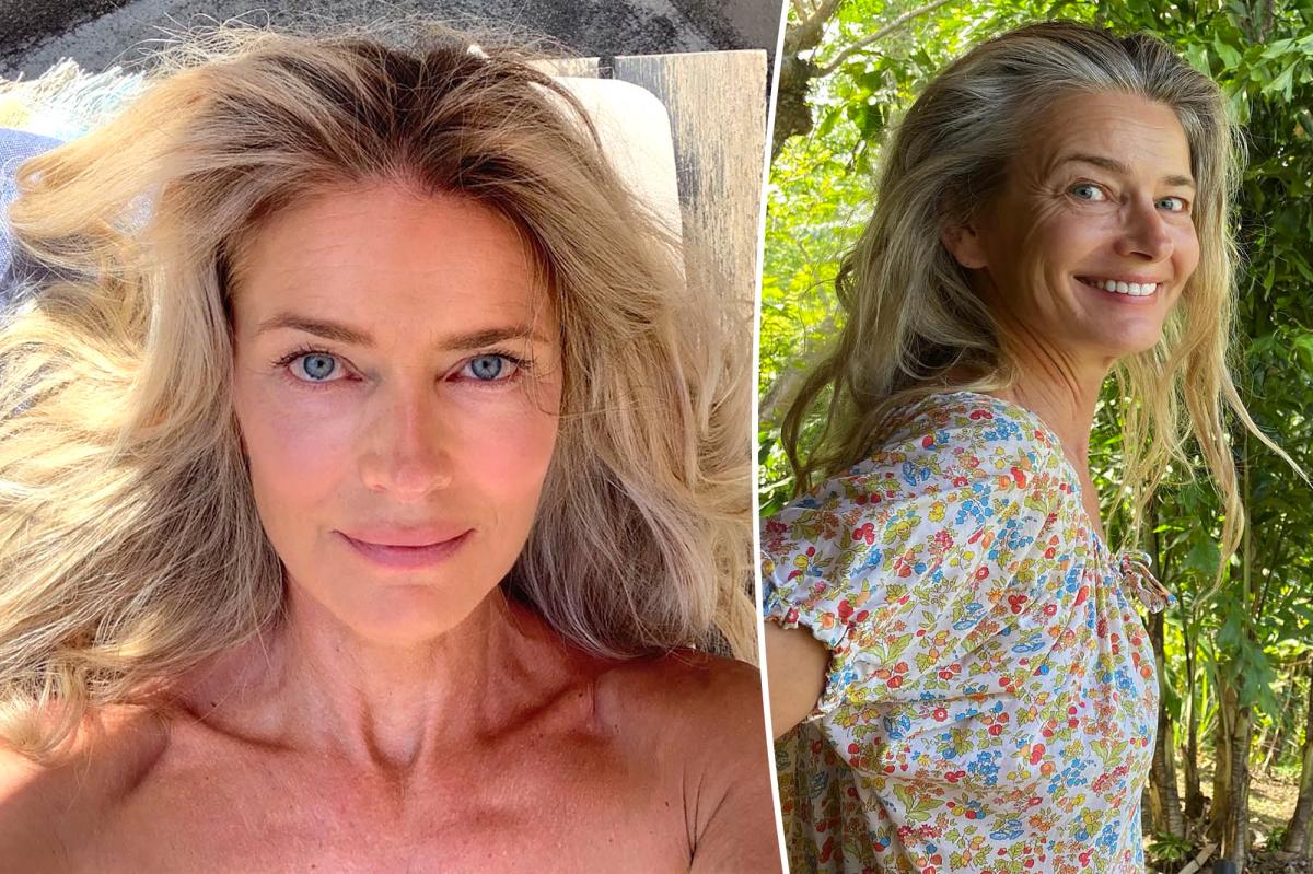 Paulina Porizkova fires back at plastic surgeon's facial criticism