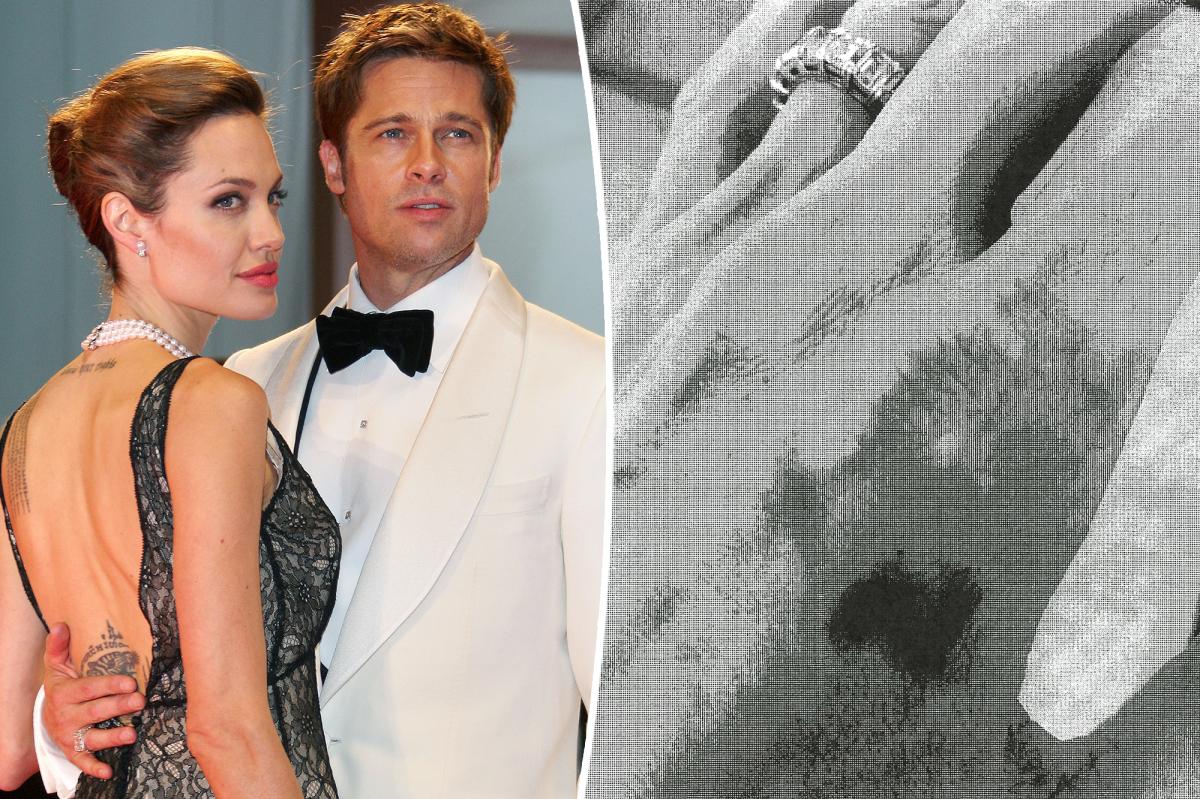 Pictures of Brad Pitt's Angelina Jolie's Alleged Bruises Revealed