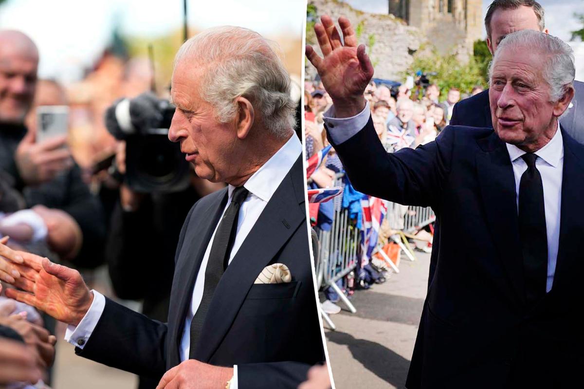 King Charles III's hands turn red and raw during Welsh greetings
