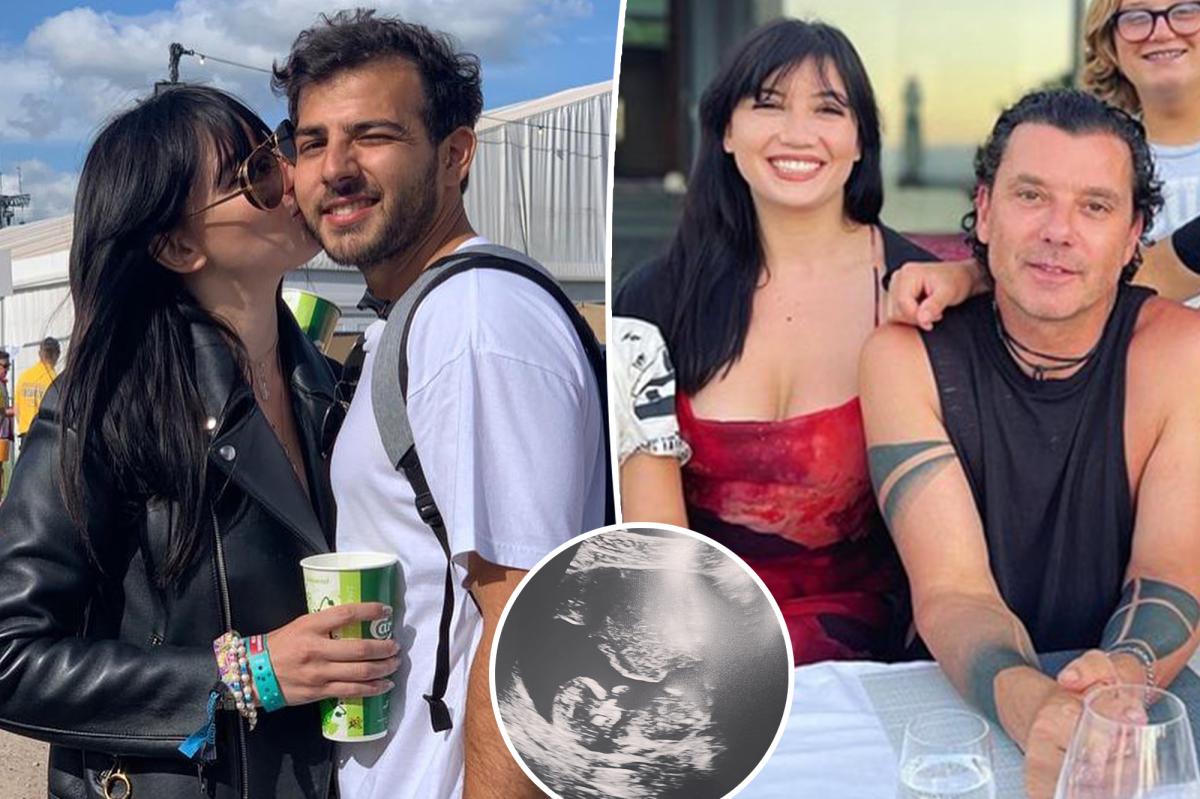 Gavin Rossdale's daughter Daisy Lowe pregnant with first baby