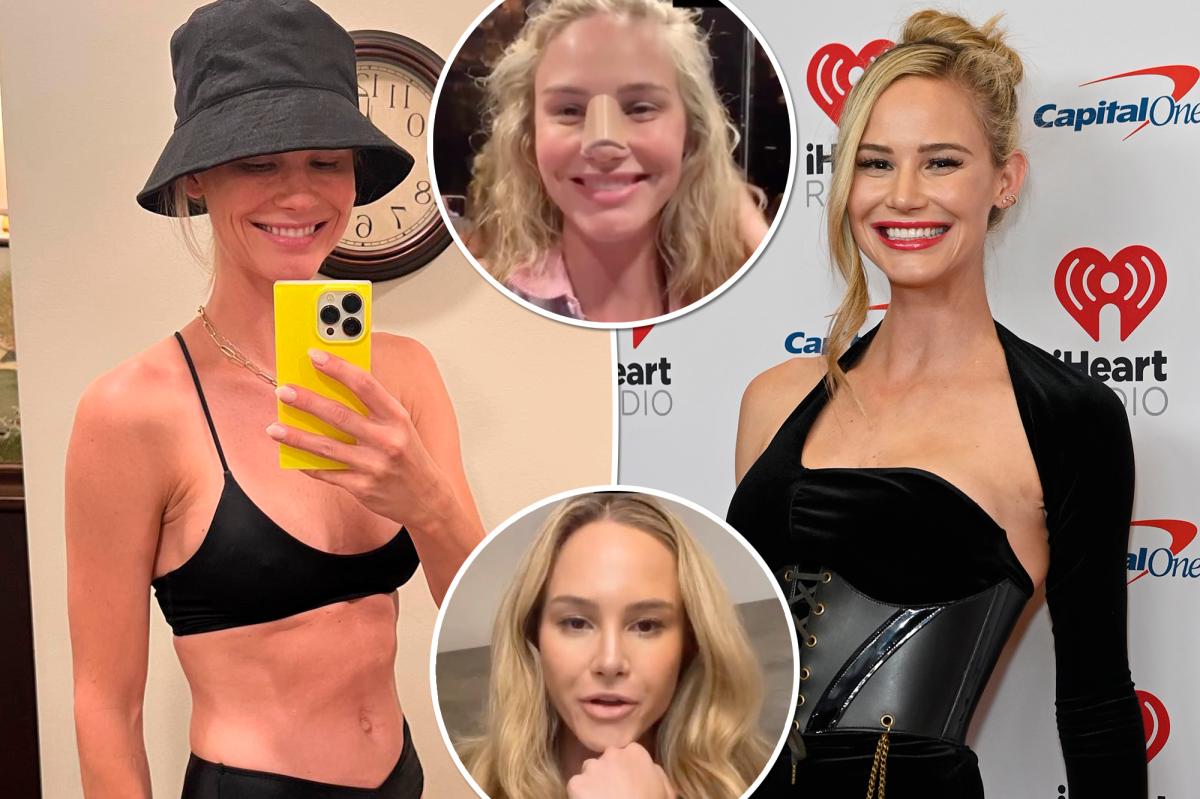 Meghan King shares recovery photos after nose and breast surgeries